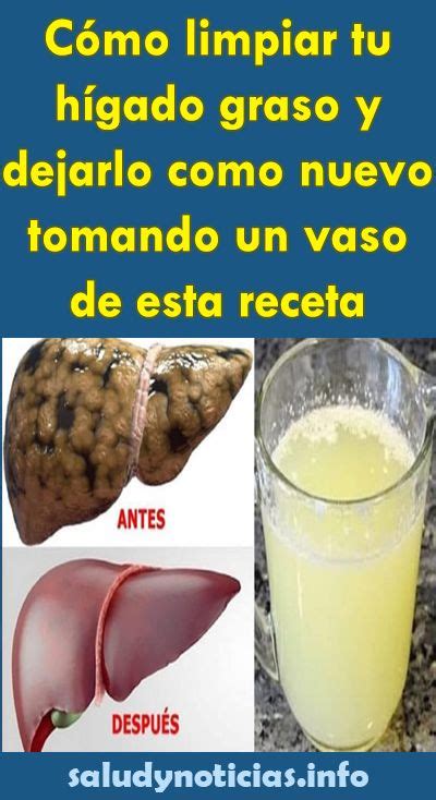 C Mo Limpiar Tu H Gado Graso Y Dejarlo Como Nuevo Tomando Un Vaso De