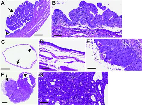 Typical Examples Of Histopathological Lesions A Urothelial Download Scientific Diagram