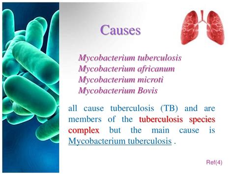 Pulmonary Tuberculosis