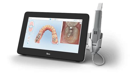 Itiero Element D Plus Digital Dentistry Blog Online Courses Training