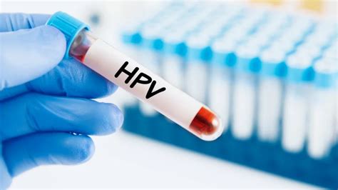 Hpv Nedir Hpv Belirtileri Tedavisi Ve Korunma Yollar