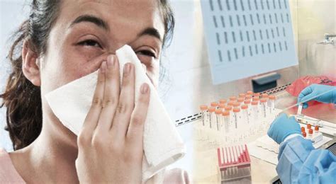 Influenza A H3n2 Geresa No Descarta Llegada Del Virus A Arequipa Y