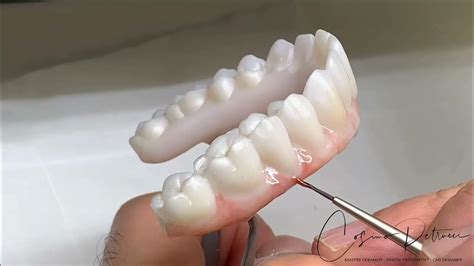 Implant Bridges Zirconia Monolithic Double Full Arch Tutorial Youtube