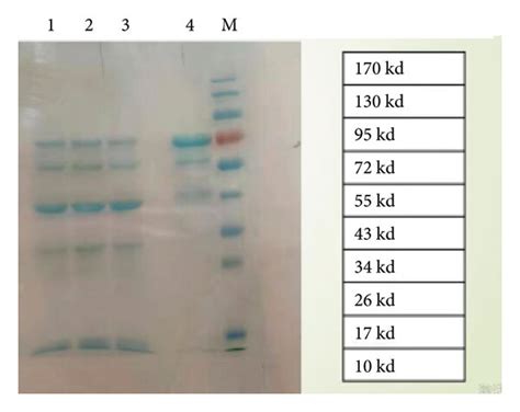 Results of SDS-PAGE analysis of purified fusion protein after MBP was... | Download Scientific ...