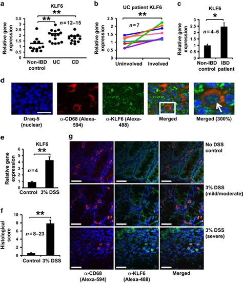 Kruppel Like Transcription Factor 6 KLF6 Is Upregulated In Inflamed