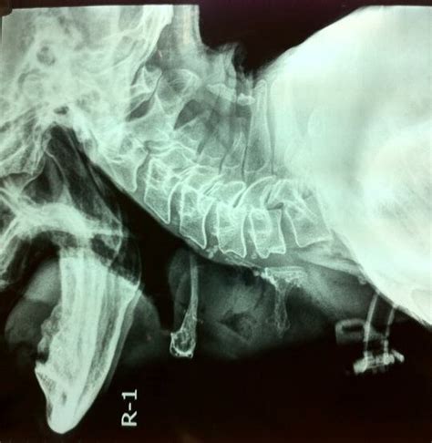 X Ray Soft Tissue Neck Lateral View Showed Well Defined Mass In Download Scientific Diagram