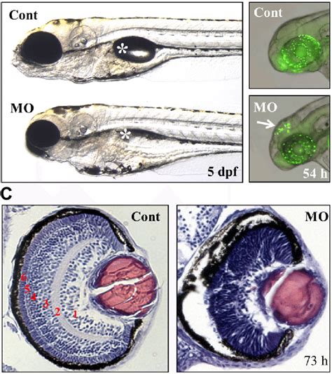 Defects In The Brain And Retina Of Ranbp Mo Injected Zebrafish