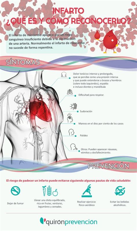 Trabajo Y Prevención Castilla Y León On Twitter ¿cómo Reconocer Si Estás Sufriendo Un Infarto