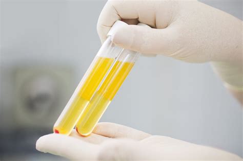 A Quantitative Uplc Msms Research Method For The Measurement Of