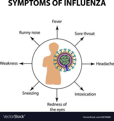 Symptoms Infections Of The Influenza Virus Vector Image