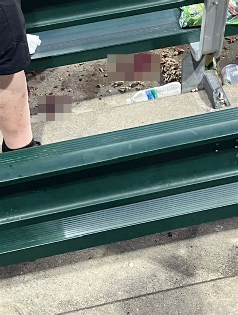 White Sox Game Shooting That Left Two Women Hurt Still Remains A Mystery After Over A Month As