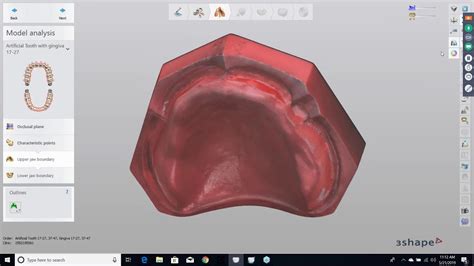 [webinar] 3d Printing Digital Dentures With Dentca Resins Part 2 With