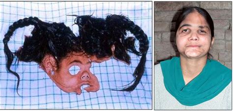 Sundeep Kuar Severed Face Laderilike