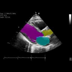 Cardiology Archives RSIP Vision