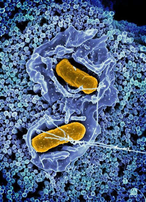 Salmonella Enterica Subsp Enterica Wikiprojectmed