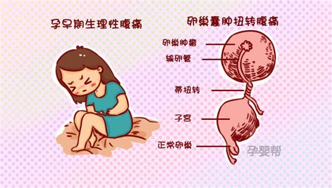 6种孕期腹痛，正常或异常要分清