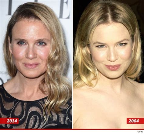 Renee Zellweger Before And After Plastic Surgery Pictures