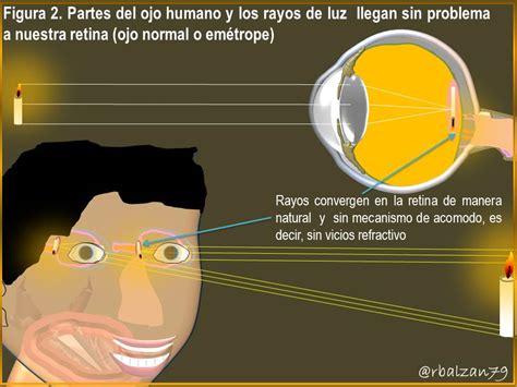 Dioptrías Poder refractivo de las lentes Parte II Hive