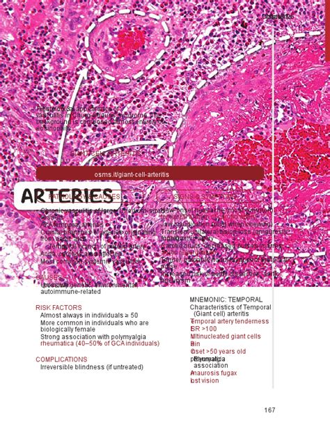 Kawasaki Disease Osmosis