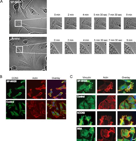 CCN3 Induces Reorganization Of Actin Filaments And Focal Adhesions A