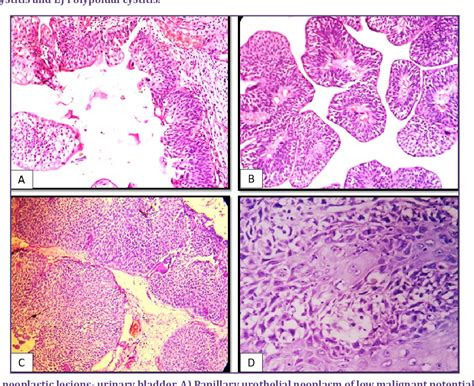 Figure 1 From A Study On Histopathological Spectrum Of Lesions In