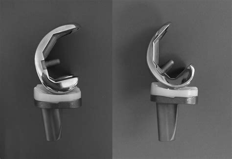 Comparison Of Standard And Gender Specific Posterior Cruciate Retaining