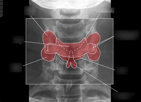 Cervical AP C5 Diagram Quizlet