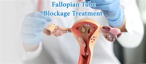 Treatment For Blocked Fallopian Tubes Symptoms And Fertility