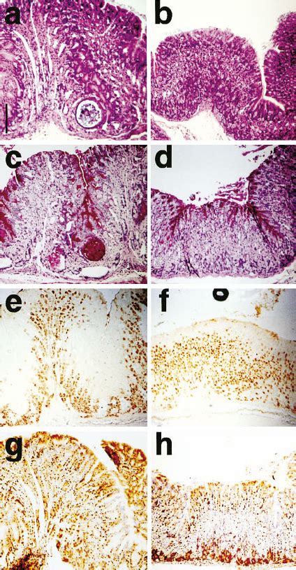 Histological Changes Observed In Gastric Mucosa From One Year Old