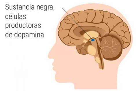 PARKINSON EP Mind Map