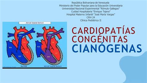 Cardiopatías Congénitas Cianógenas Cesar Udocz