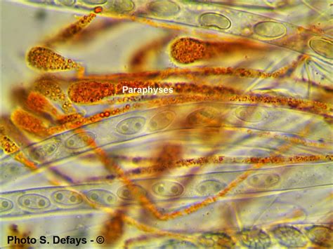 Microscopie Paraphyses De Aleuria Aurantia Peziza Aurantia F