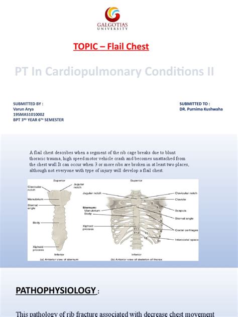 Flail Chest By Varun Arya Pdf Thorax Clinical Medicine