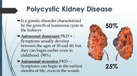 Polycystic kidney disease