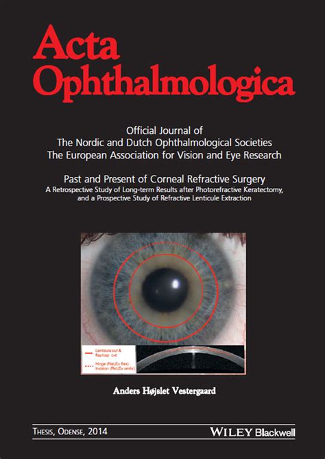 Past And Present Of Corneal Refractive Surgery Vestergaard 2014