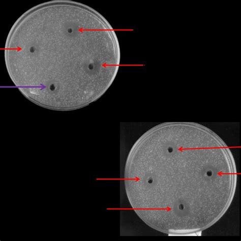 Zone Of Inhibition Of Synthesized Derivatives Against Staphylococcus