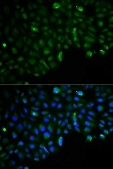 Hexokinase II Antibody - Cat. No. 13-360 | ProSci