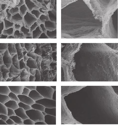 Scanning Electron Micrographs Of Intramuscular Connective Tissue