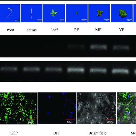 Tissue Specific Expression And Subcellular Localization Of Zbagl11 A