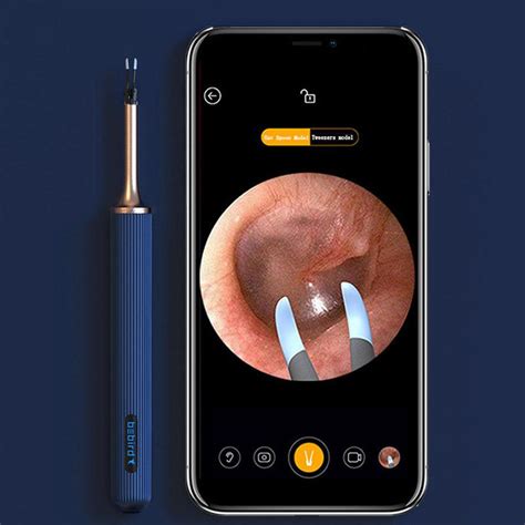 BeBird Note 3 Pro Robotic Smart Visual Ear Cleaning Endoscope BeBird