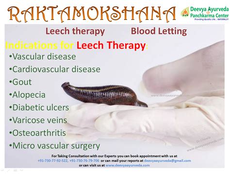 Leech Therapy In Ayurveda