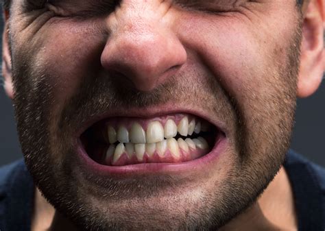 What Is Bruxism And How Do I Stop Clenching And Grinding