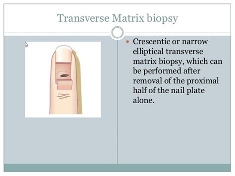 Nail Biopsy