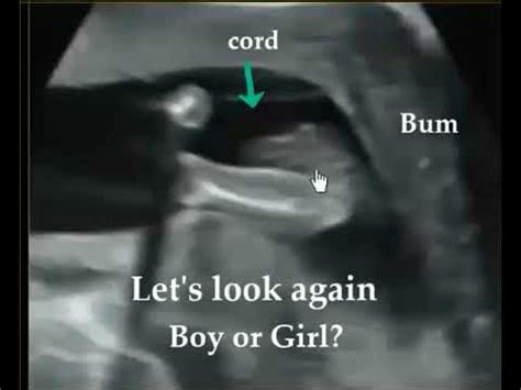 WRONG GENDER BABY ULTRASOUND HERE IS WHY YouTube