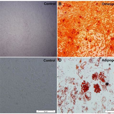 In Vitro Differentiation Of HESC MSCs Osteogenic And Adipogenic