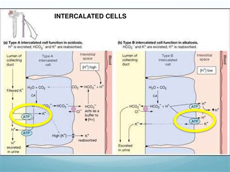 Hypokalemia Diagnosis Causes And Treatment