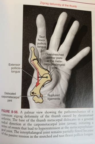 Kinesiology Quiz 4 Wrist Complex Flashcards Quizlet