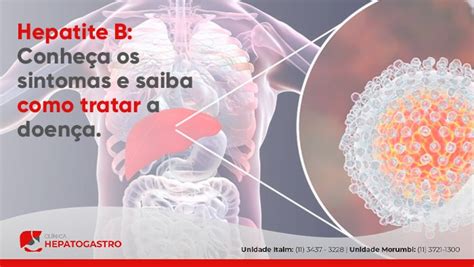 Hepatite B Conhe A Os Sintomas E Saiba Como Tratar A Doen A Cl Nica