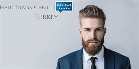 Hair Transplant Turkey Reviews Are Helping People - Spiegel News