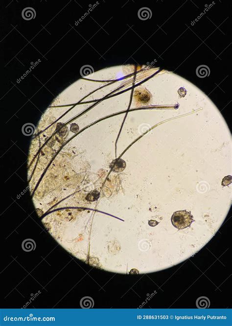 Notoedres Cati Under The Microscope Notoedric Mange Also Referred To As Feline Scabies Stock